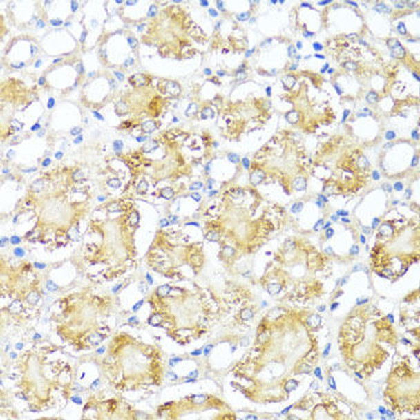 Anti-MAS1 Antibody (CAB8132)