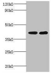 GLT8D2 Antibody (PACO27045)