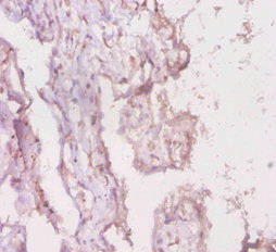 LRBA Antibody (PACO28013)