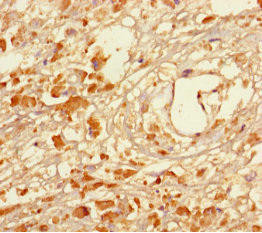 MAGEA5 Antibody (PACO28110)
