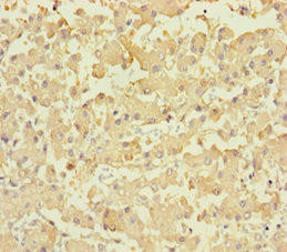 PLPPR2 Antibody (PACO29164)