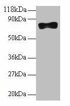 Samhd1 Antibody (PACO29744)