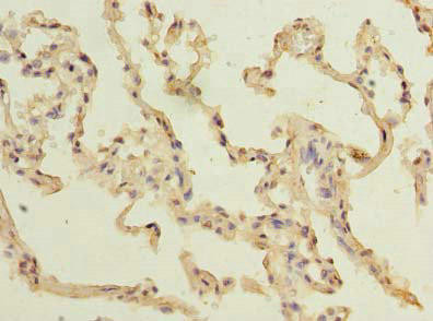 TM4SF1 Antibody (PACO30434)