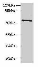TMEM161A Antibody (PACO30498)