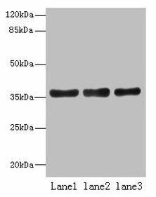UPP2 Antibody (PACO31004)
