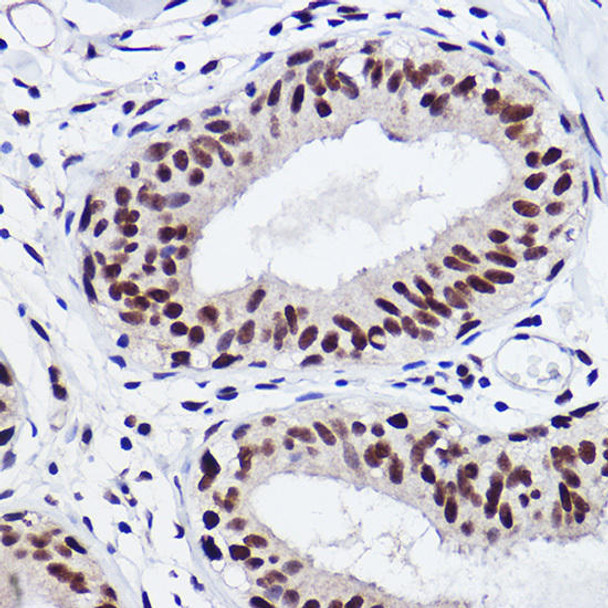 Anti-GTF2I Antibody (CAB0542)