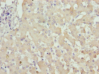 ZFP69B Antibody (PACO31448)