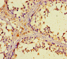ZNF662 Antibody (PACO31452)