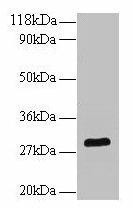 Bdnf Antibody (PACO33724)