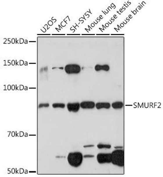 Anti-SMURF2 Antibody (CAB2278)