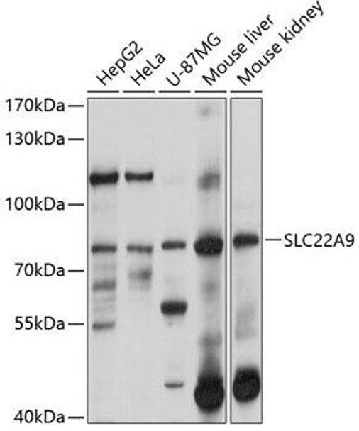 Anti-SLC22A9 Antibody (CAB10434)