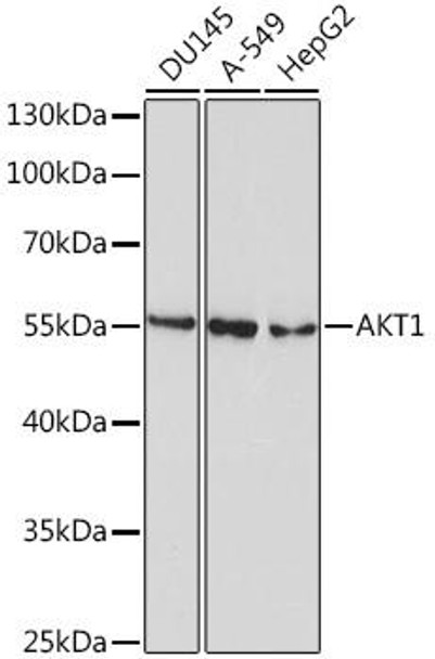 Anti-AKT1 Mouse Monoclonal Antibody (CAB10605)