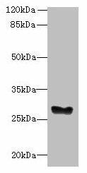 GPM6B Antibody (PACO35366)