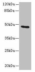 KRT33B Antibody (PACO35638)