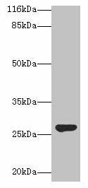 IZUMO4 Antibody (PACO35830)