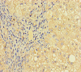 PRICKLE4 Antibody (PACO35886)