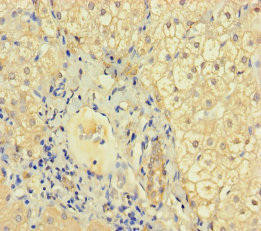 KRT71 Antibody (PACO35934)