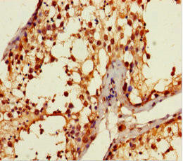ANKDD1A Antibody (PACO36002)