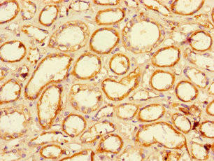 LACTB2 Antibody (PACO36242)