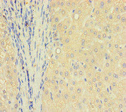 TXNDC8 Antibody (PACO36390)