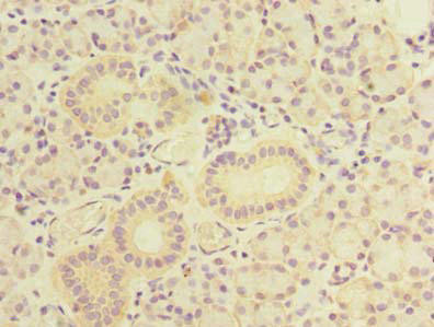 TBC1D9B Antibody (PACO36470)
