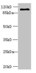 AGBL2 Antibody (PACO36602)