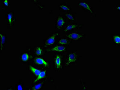 PQLC2 Antibody (PACO36786)
