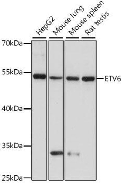 Anti-ETV6 Antibody (CAB15668)