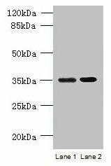CFAP65 Antibody (PACO37034)
