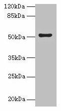 SLC46A3 Antibody (PACO37446)