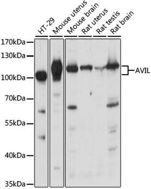 Anti-AVIL Antibody (CAB15785)