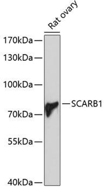 Anti-SCARB1 Antibody (CAB1584)