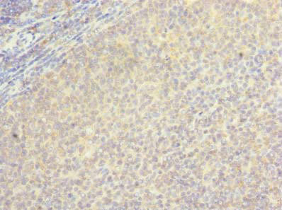 BORCS5 Antibody (PACO38106)