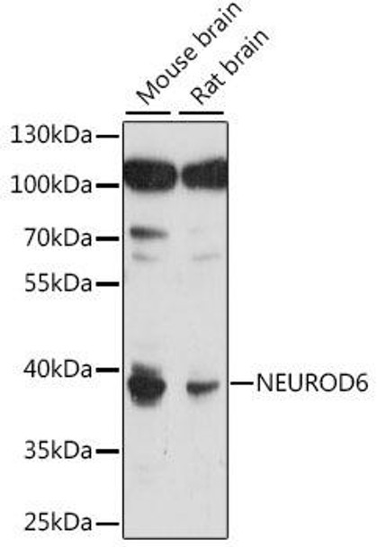 Anti-NEUROD6 Antibody (CAB15881)