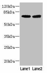 GALNT15 Antibody (PACO38246)