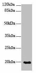 NUDT11 Antibody (PACO38450)