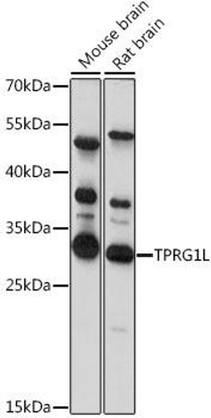 Anti-TPRG1L Antibody (CAB15949)