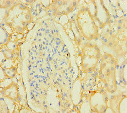 PPTC7 Antibody (PACO38594)