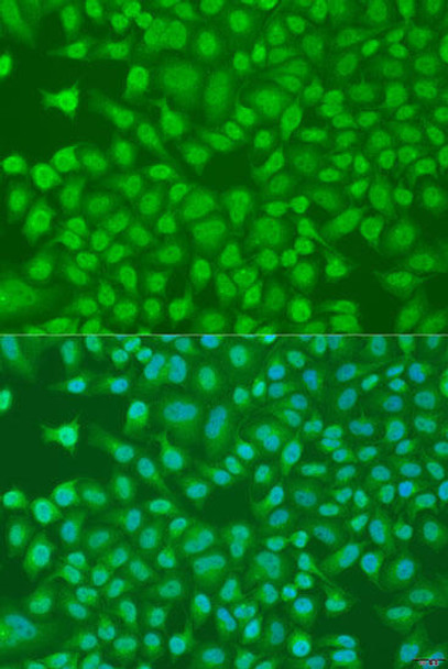 Anti-PLEKHA1 Antibody (CAB16009)