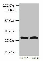 RTP4 Antibody (PACO38958)