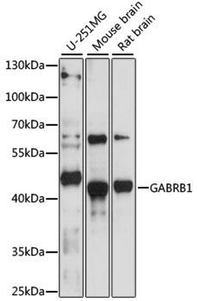 Anti-GABRB1 Antibody (CAB16015)