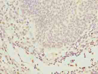 GLT1D1 Antibody (PACO39018)