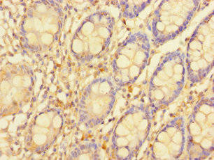 SGTB Antibody (PACO39310)