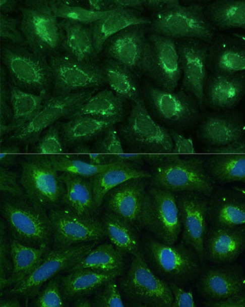 Anti-ABCD2 Antibody (CAB16033)