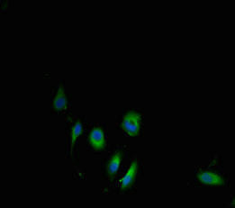 Cbs Antibody (PACO39514)