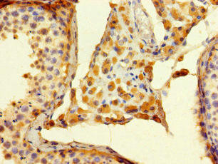 ALG14 Antibody (PACO39582)