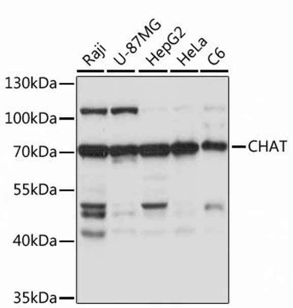 Anti-CHAT Antibody (CAB16818)