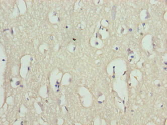 RHPN1-AS1 Antibody (PACO40986)