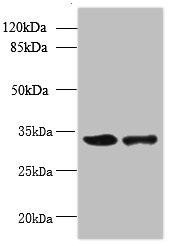 RWDD2A Antibody (PACO41810)