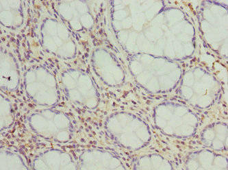 FMO1 Antibody (PACO44477)